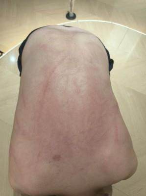 【爱秀套图】【女神学院·诗琪】超狠高跟鞋跟踩伤 YC-250309