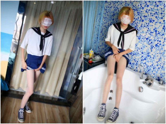 【网盘】[纳丝摄影]-NO.00b 王者A+