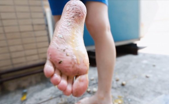 【网盘】〖H.P.L栖心之栈〗—采萱踩爆100个鹌鹑蛋 HPL-230315